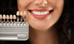 Composite Veneers from £445