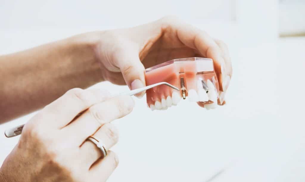 Are single implants right for you?