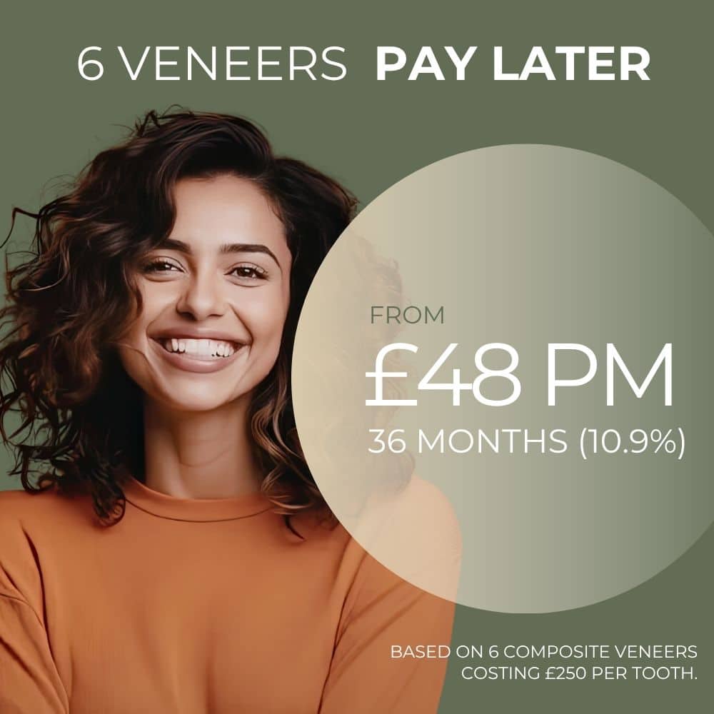 veneers finance