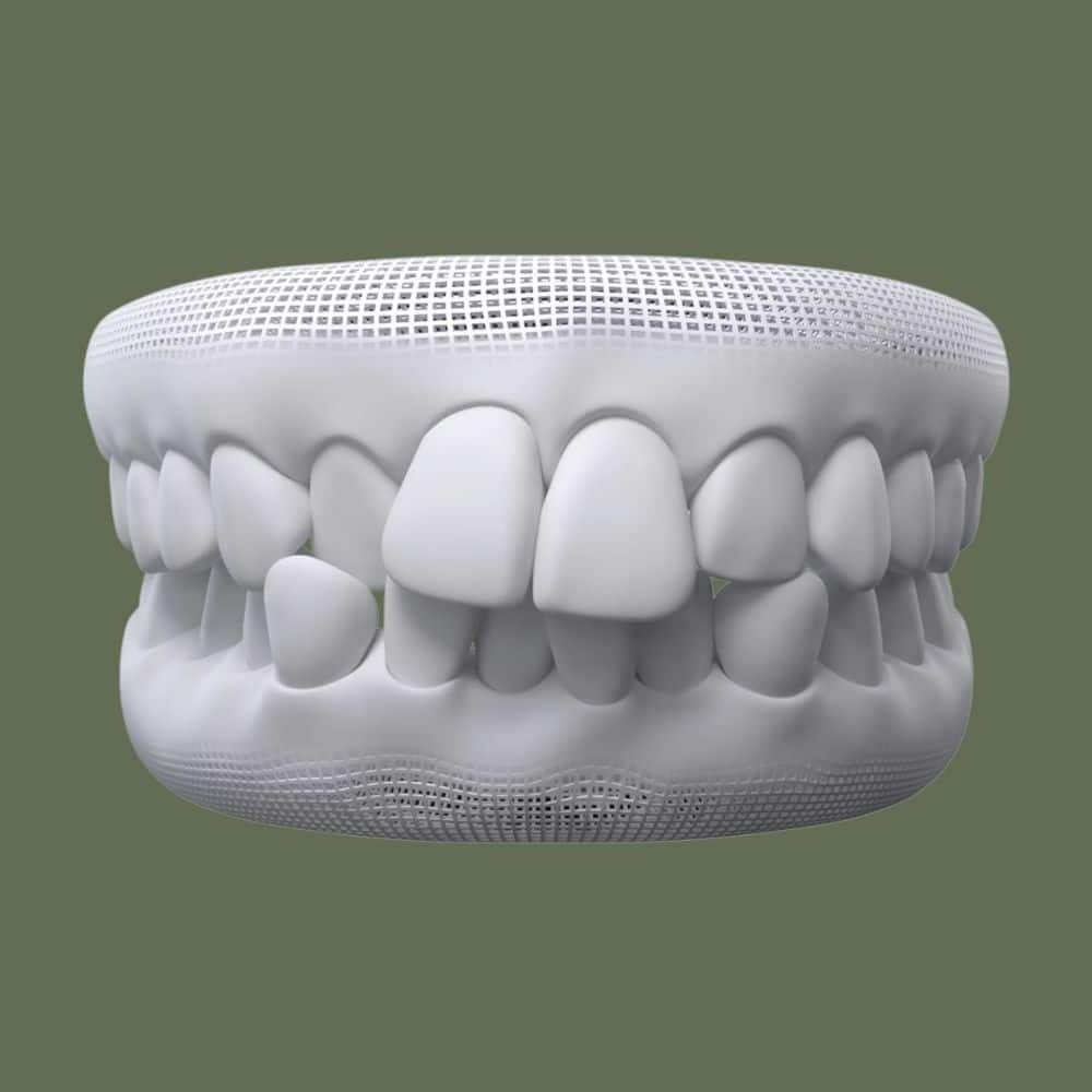 crowded teeth