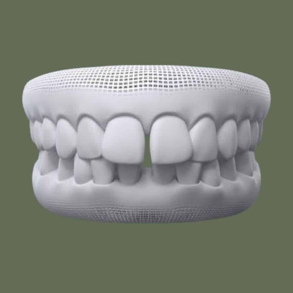 gapped teeth