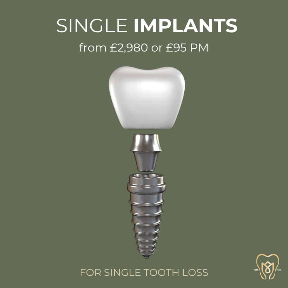 single implants