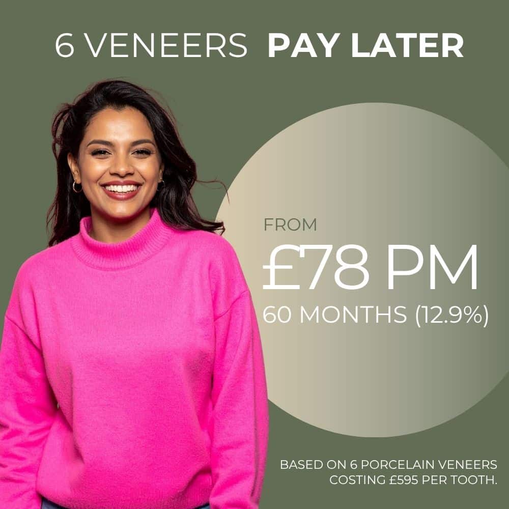 Porcelain veneer finance