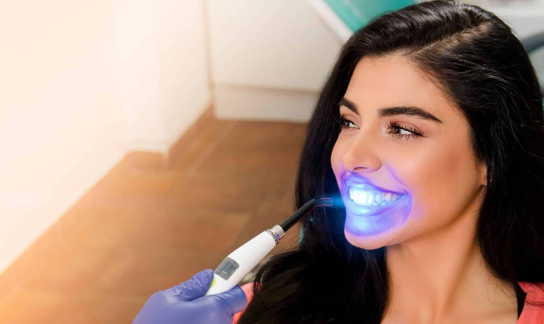 straighter smile result